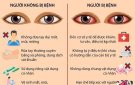 Tuyên truyền phòng tránh bệnh đau mắt đỏ